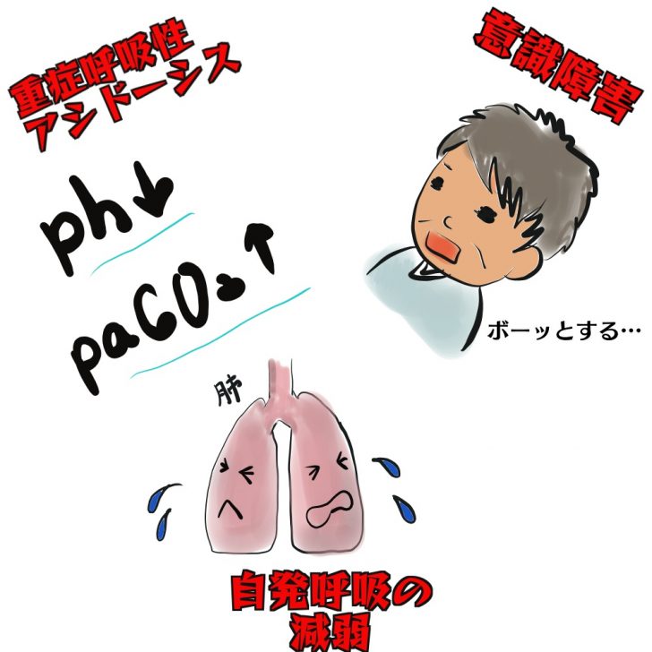 Co2ナルコーシスがわかる！わかりやすい図解で解説。原因、症状等 看護師になったシングルマザーのブログ